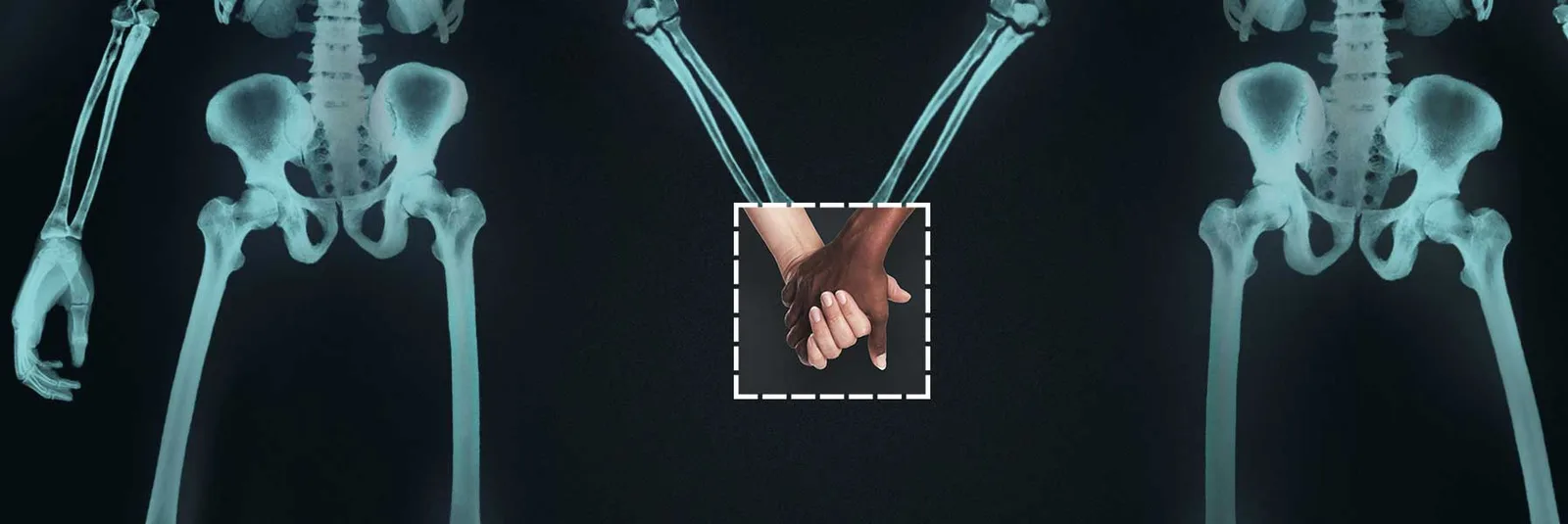 Campaign graphic with two skeletons and a framed photograph of clasped hands.